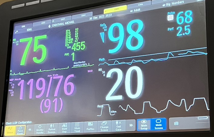 I need a favor – (or A Tale of Two Heart Attacks) – you decide